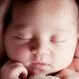 Newborn Skin-Care: Rashes, Umbilical Cord Care, Bathing & Baby Products