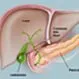 Picture of Gallbladder