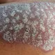 Psoriasis Quiz: Test Your Medical IQ