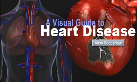  A Visual Guide to Heart Disease