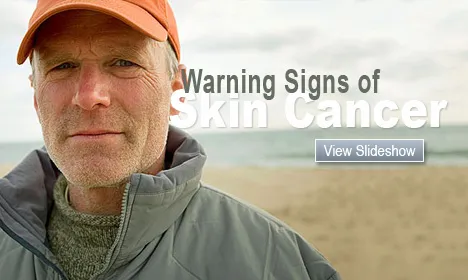 Skin Cancer Pictures Slideshow Warning Signs of Skin Cancer